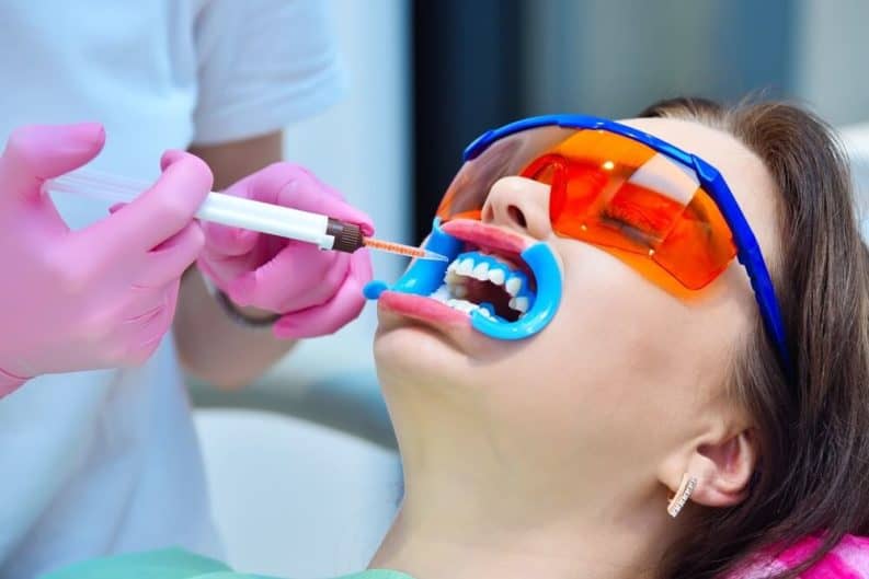 Get a brighter smile in minutes with instant results whitening Colchester