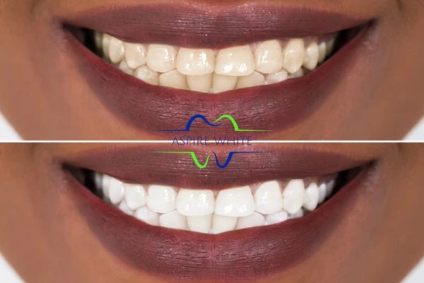 Side-by-side comparison showing before and after results of a cosmetic treatment Colchester