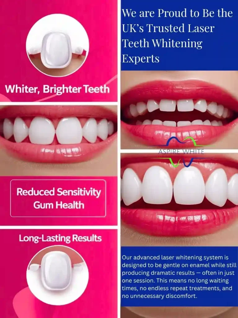 We are Proud to Be the UK’s Trusted Laser Teeth Whitening Experts Colchester